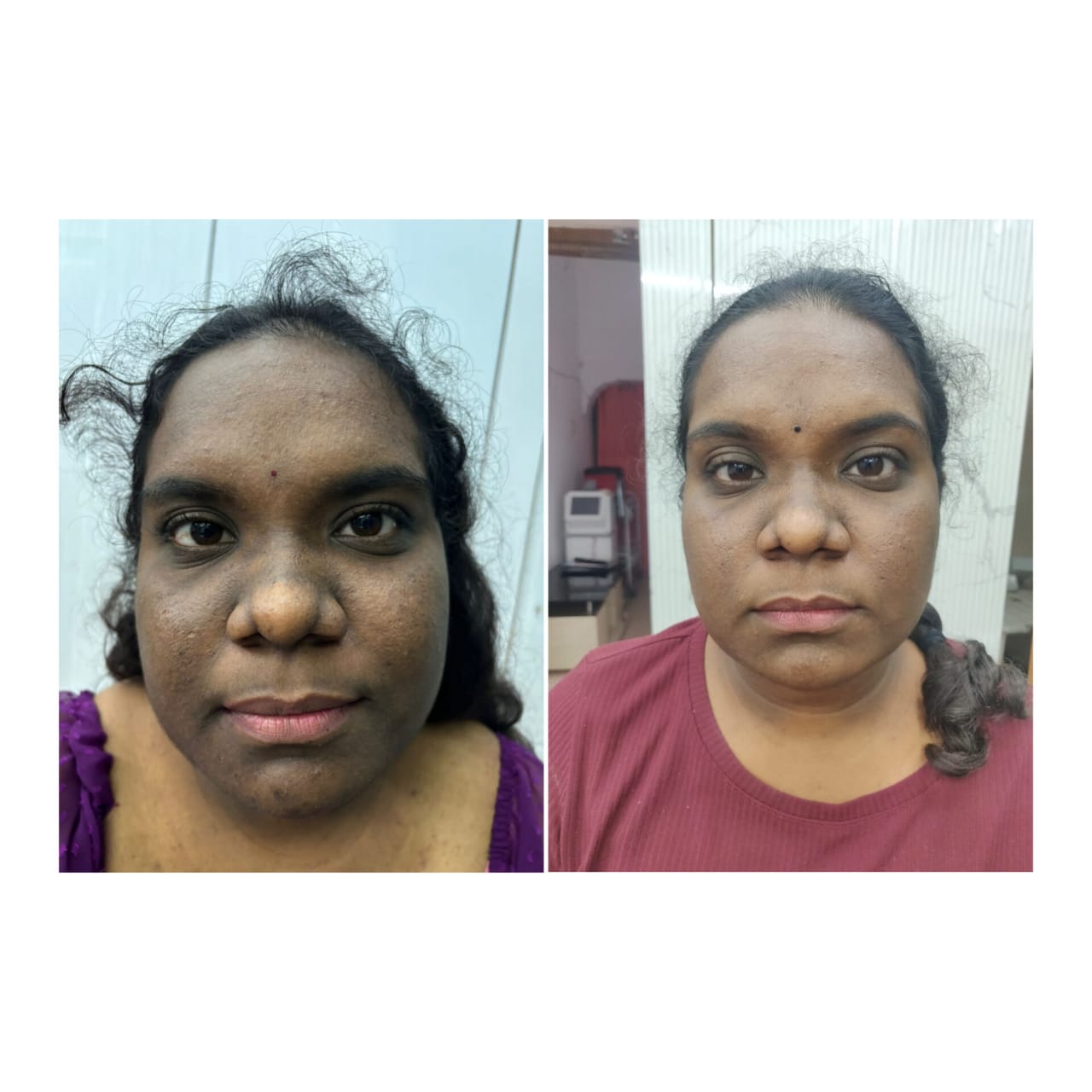 Anti-Ageing Therapy